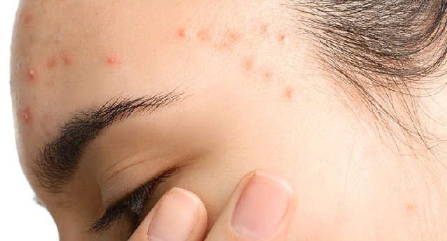 Ai không nên ăn bánh Trung thu ?