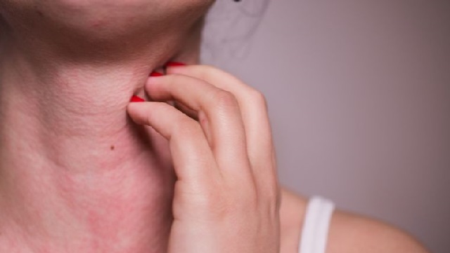 Các triệu chứng thường gặp khi bị dị ứng thịt gà