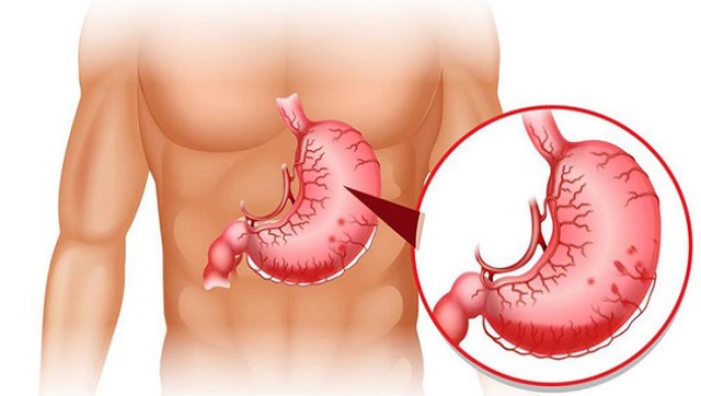 Cấu tạo và chức năng của dạ dày