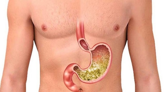 Cấu tạo và chức năng của dạ dày