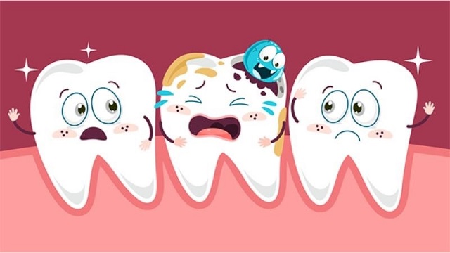 Chế độ dinh dưỡng khoa học giúp ngừa sâu răng hiệu quả