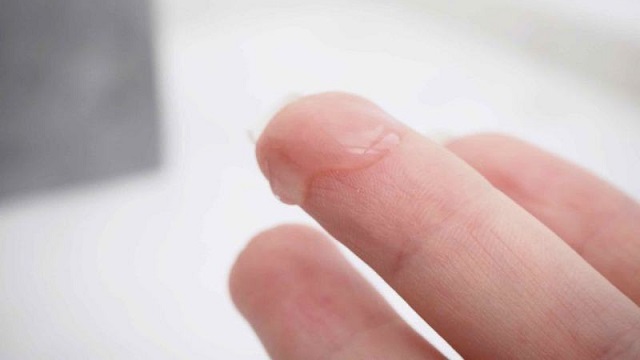 Cô bé không tiết chất nhờn và những giải pháp cần thiết