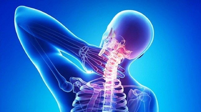 Dân văn phòng có nguy cơ cao bị thoái hóa đốt sống cổ