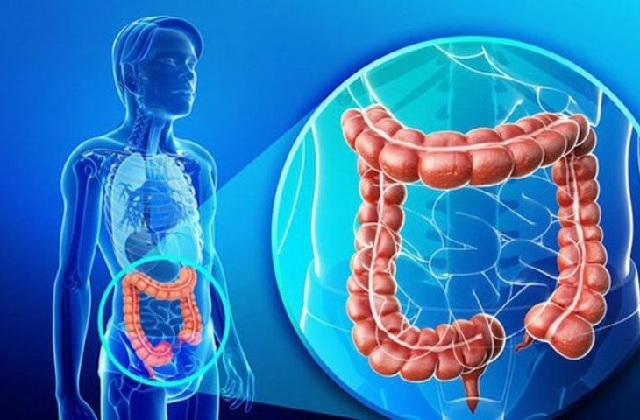 Đau cơ xơ hóa có liên quan tới hội chứng ruột kích thích