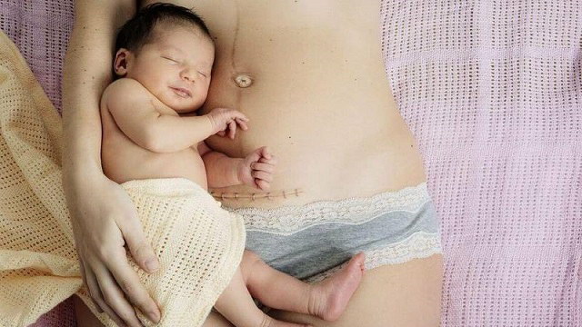 Dinh dưỡng cho mẹ sau sinh mổ