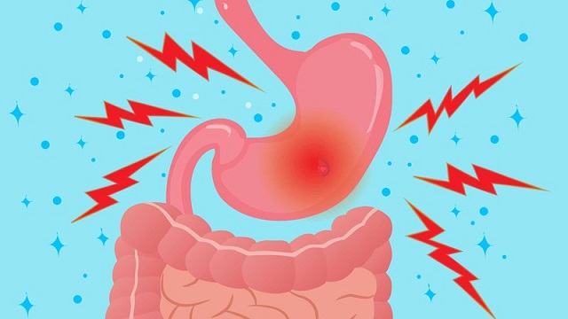 Hiểu về chứng rối loạn tiêu hóa thường gặp