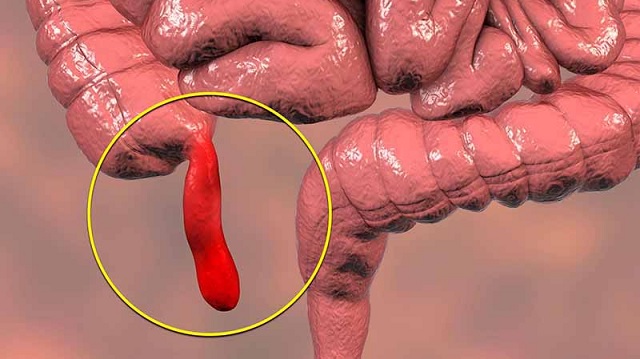 Hiểu về tình trạng dau bụng ở vị trí trên rốn