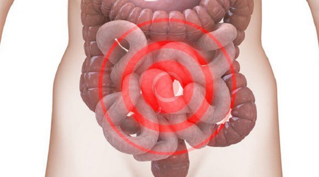 Hội chứng ruột kích thích ở người lớn là gì?