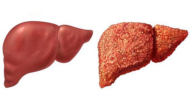 Khởi động lại chức năng gan