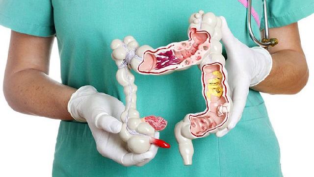 Một số biện pháp giúp làm sạch đại tràng an toàn
