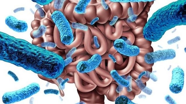 Một số nguyên nhân thường gặp gây rối loạn đại tiện