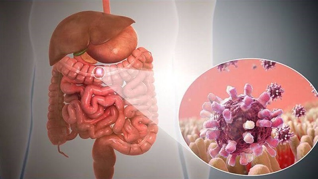 Người bị viêm đường ruột nên ăn gì?