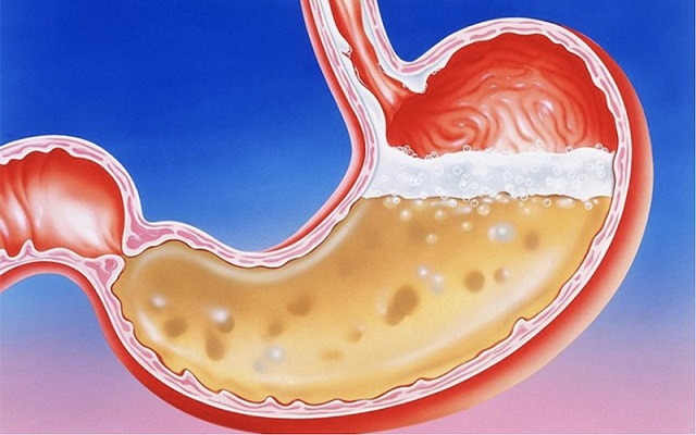 Những người chống chỉ định với men tiêu hóa