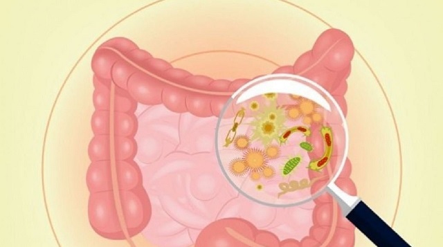 Những nguyên nhân gây sôi bụng và cách khắc phục