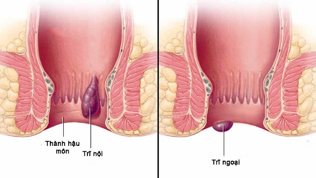 Những tác hại không ngờ tới của việc ăn cay