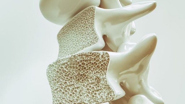 Thực phẩm ngừa loãng xương cho phụ nữ mãn kinh