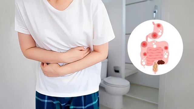 Tìm hiểu hội chứng ruột lười biếng